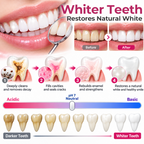 Timilk® DenPerm Cavity-Repair Natural Enamel Filling Gel